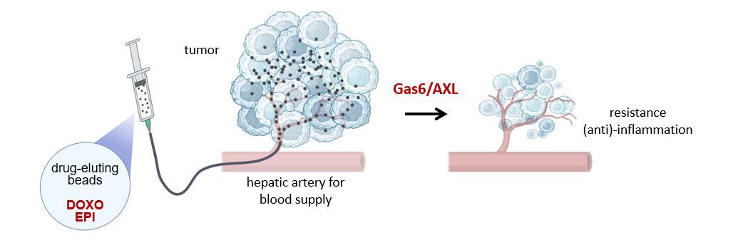 AXL signaling during TACE treatment of hepatocellular carcinoma