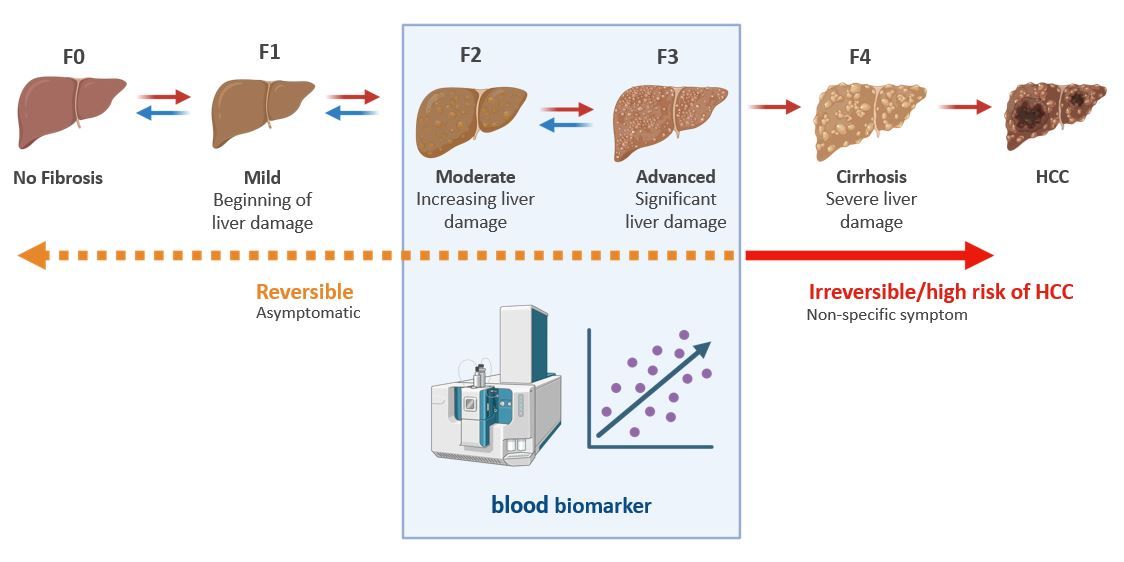Biomarkers of liver fibrosis to prevent liver cancer