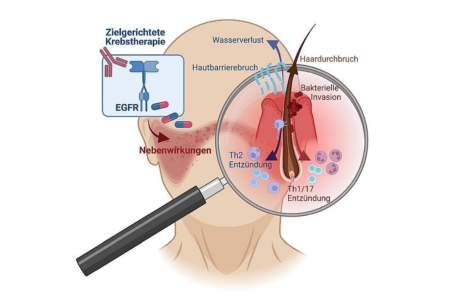 Nebenwirkung der Krebstherapie