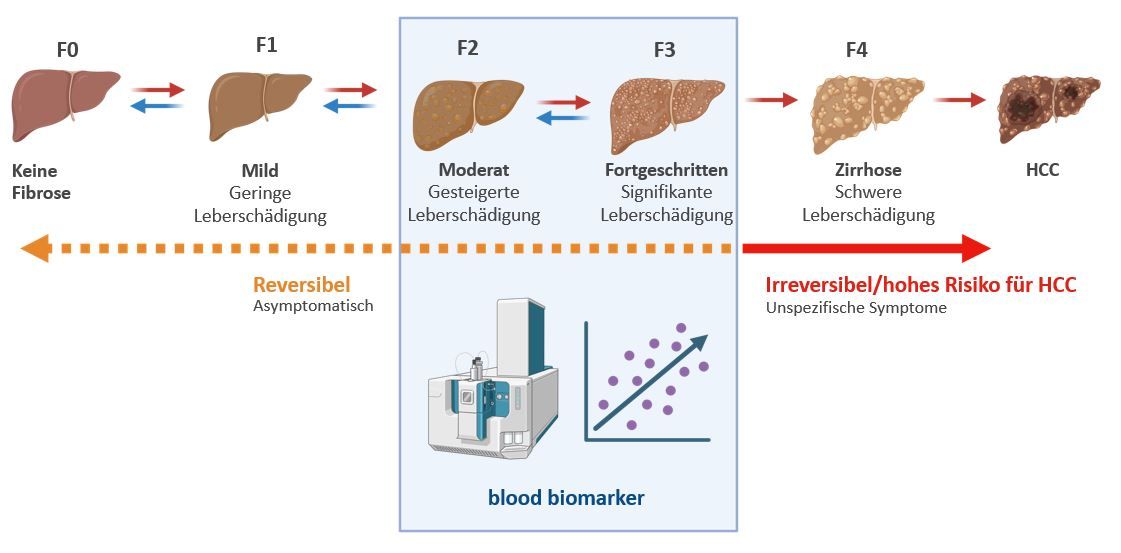 Biomarker der Leberfibrose zur Vorbeugung von Leberkrebs